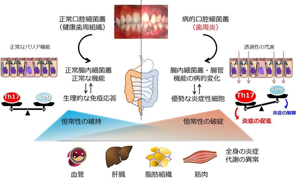 腸内細菌・口腔細菌と全身疾患 (バイオテクノロジー)